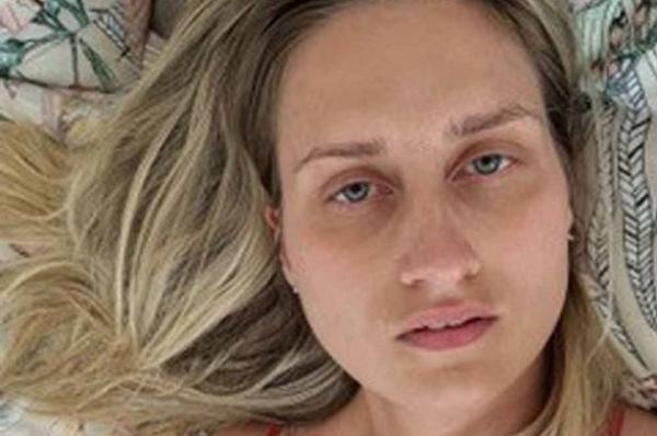 بريطانية تعاني من حالة صحية نادرة تجعلها تشعر بالغرق